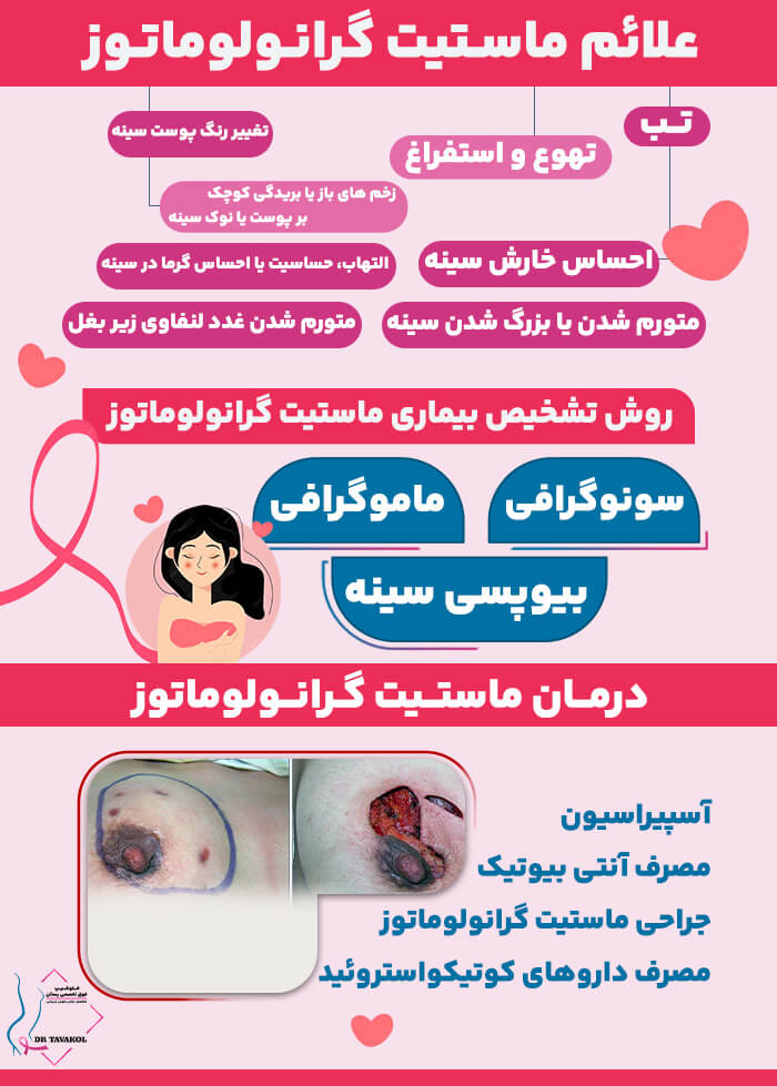 علائم و نشانه های ماستیت گرانولوماتوز سینه